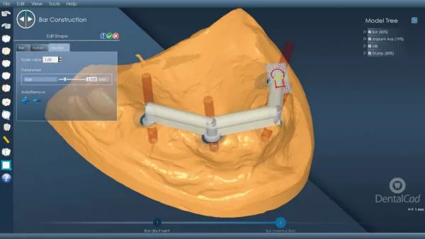 Máy quét 3D eviXscan Dentica